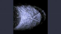 Endless Forms – Lungs