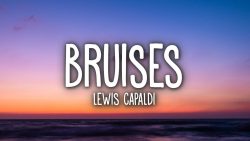 Lewis Capaldi – Bruises